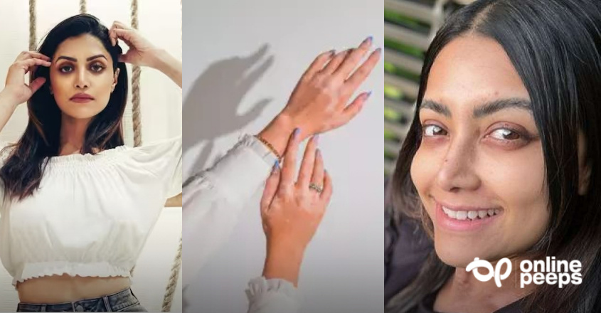 ‘എന്റെ ശരീരത്തിന്റെ നിറം നഷ്ടമാകുന്നു’; രോഗാവസ്ഥയെ കുറിച്ച് തുറന്നു പറഞ്ഞ് മംമ്ത മോഹന്ദാസ്